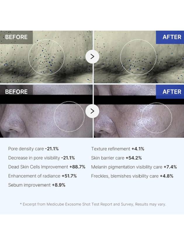 [MEDICUBE] One-Day Exosome Shot Pore Ampoule 2000 30ml - MEDICUBE - BALAAN 4