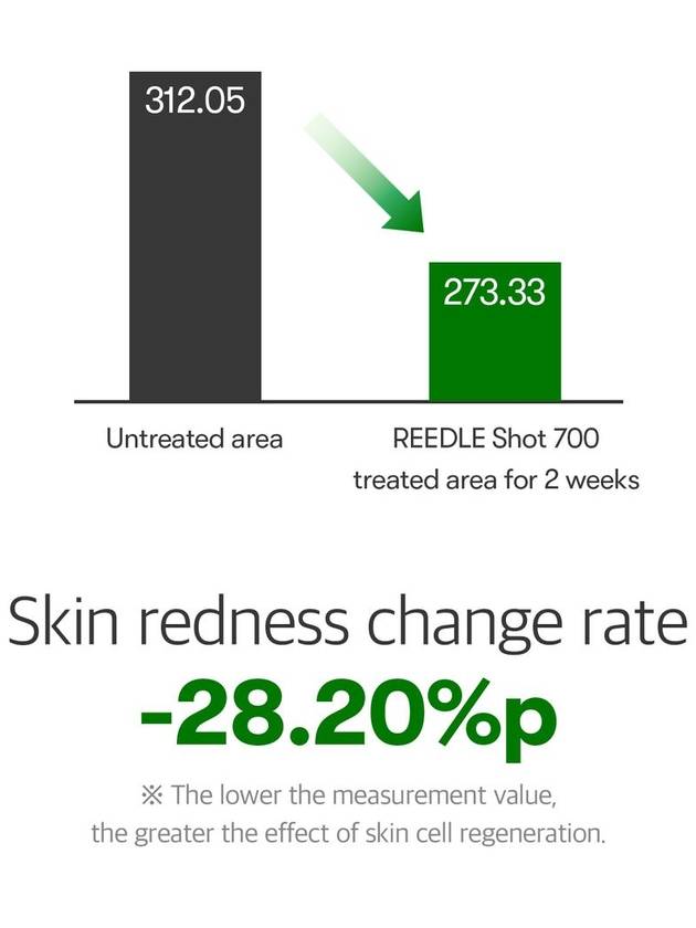 [VT Cosmetics] Reedle Shot 700 - VT COSMETICS - BALAAN 8